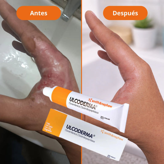 ULCODERMA UNGÜENTO 15gr