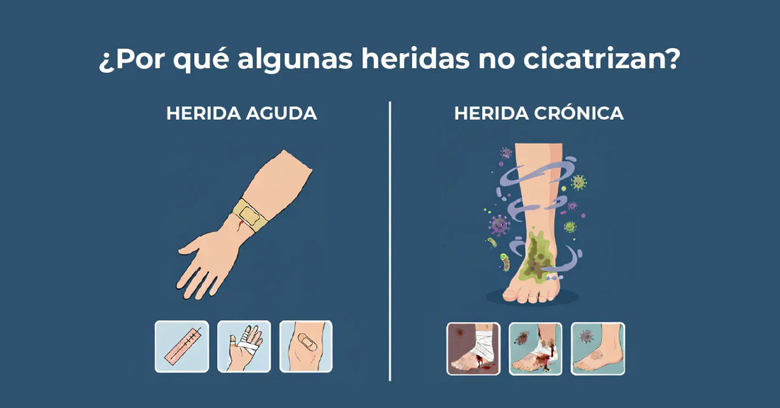 Diferencias entre heridas agudas y crónicas: por qué algunas heridas no cicatrizan