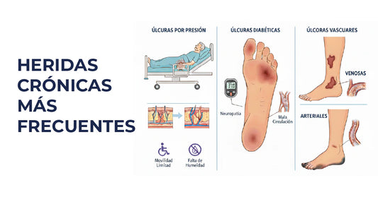 Heridas crónicas más frecuentes: úlceras por presión, diabéticas y vasculares