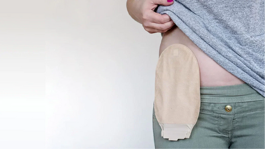Vivir con ostomía: cuidados diarios y consejos para mantener la piel sana