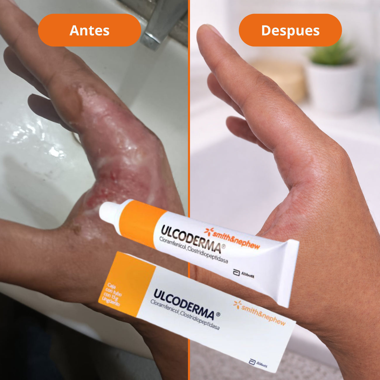 ULCODERMA 15GR UNGÜENTO